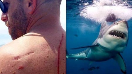 Акула напала на этого мужчину, а в итоге спасла ему жизнь