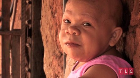 Тридцатилетний "младенец" проживает в Бразилии