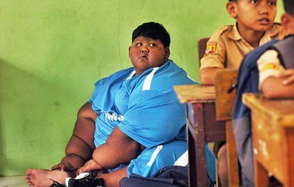 Самый толстый в мире мальчик заново научился ходить и отправился в школу
