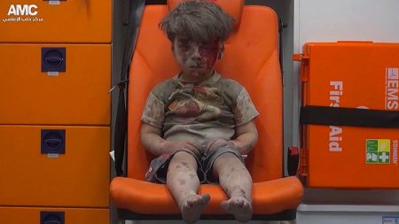  Фото дня: Сирийский мальчик в машине «скорой помощи»