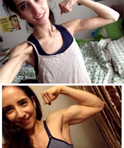После нескольких лет страданий от анорексии, девушка смогла накачать мышцы и сейчас выглядит сногсшибательно