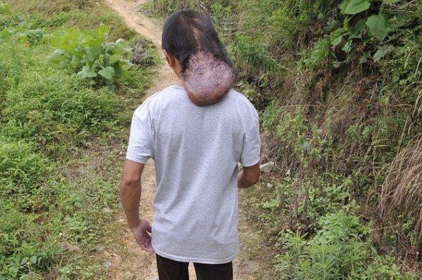 Человек-осьминог из китайской глубинки