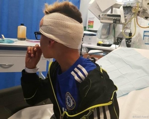 Хулиганы забили гвоздь в череп мальчика-аутиста, который отстал от родителей