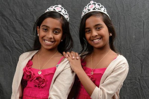 Разделенные сиамские близнецы выросли и превратились в красавиц