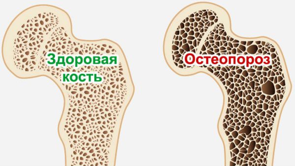 Китаянка «постарела» на 30 лет из-за того, что очень любила кофе