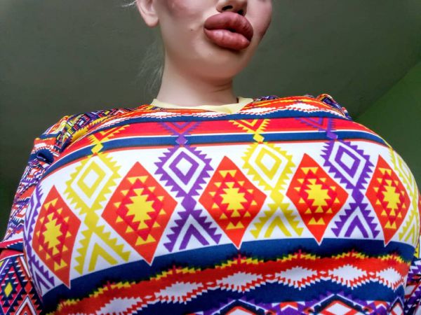 Болгарская студентка увеличила губы в три раза и не собирается останавливаться на достигнутом